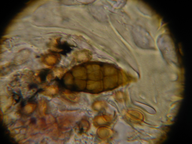 Micro di Ganoderma resinaceum